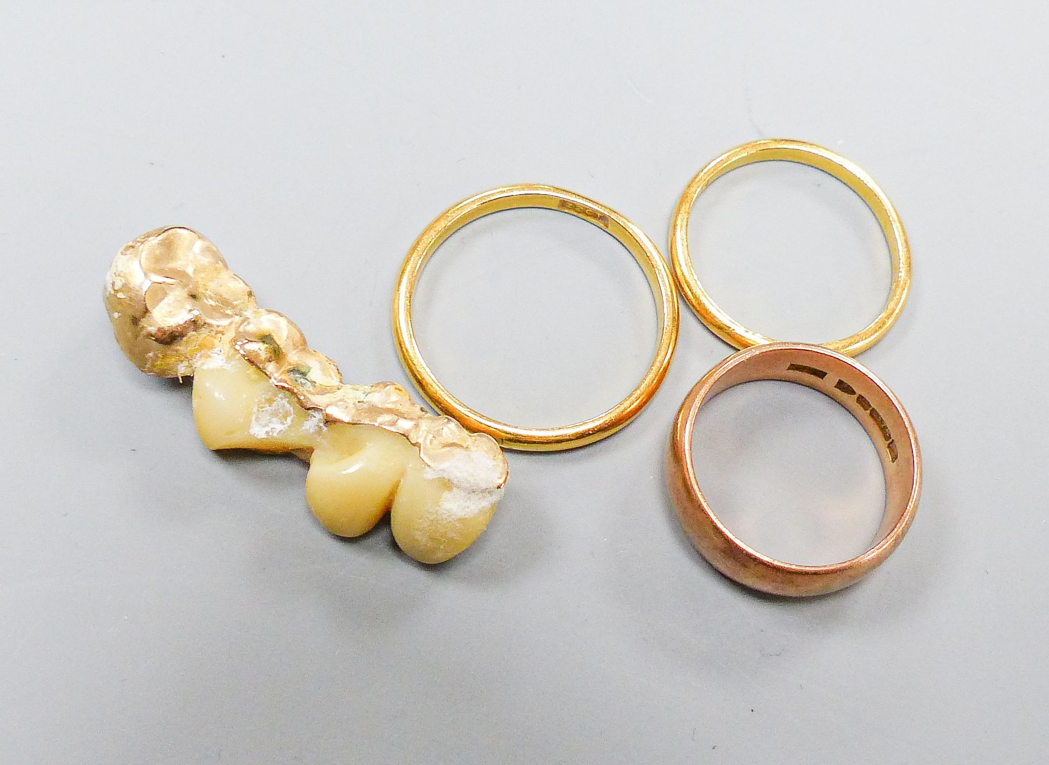 Two 22ct wedding rings, 5.7 grams, a 9ct rose gold wedding band 4.6 grams and four gold-mounted teeth.